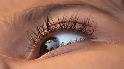 Cienie pod oczami – przyczyny i skuteczne domowe sposoby