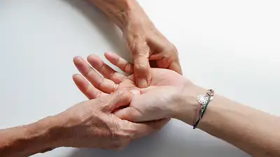 Nadpotliwość dłoni: przyczyny, objawy i skuteczne metody lec