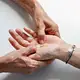 Nadpotliwość dłoni: przyczyny, objawy i skuteczne metody lec